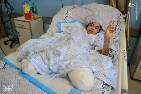 دختر ۱۳ ساله فلسطینی در غزه : « پاهایم را میخواهم » دختر ۱۳ ساله فلسطینی در غزه : « پاهایم را میخواهم »