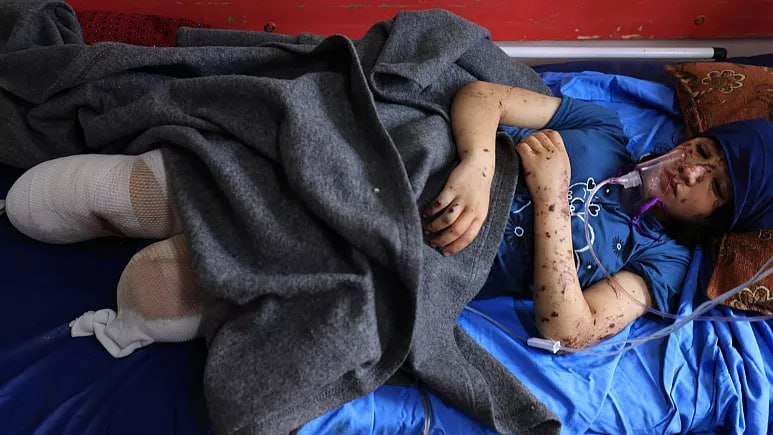 دختر ۱۳ ساله فلسطینی در غزه : « پاهایم را میخواهم » دختر ۱۳ ساله فلسطینی در غزه : « پاهایم را میخواهم »